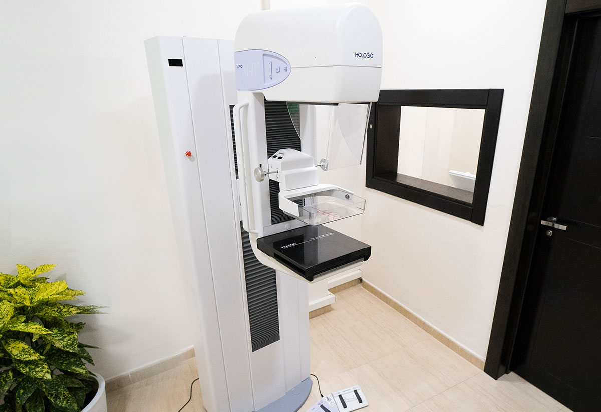 mamografia-malaga-1