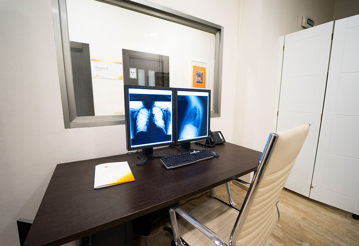 radiodiagnostico-malaga-1