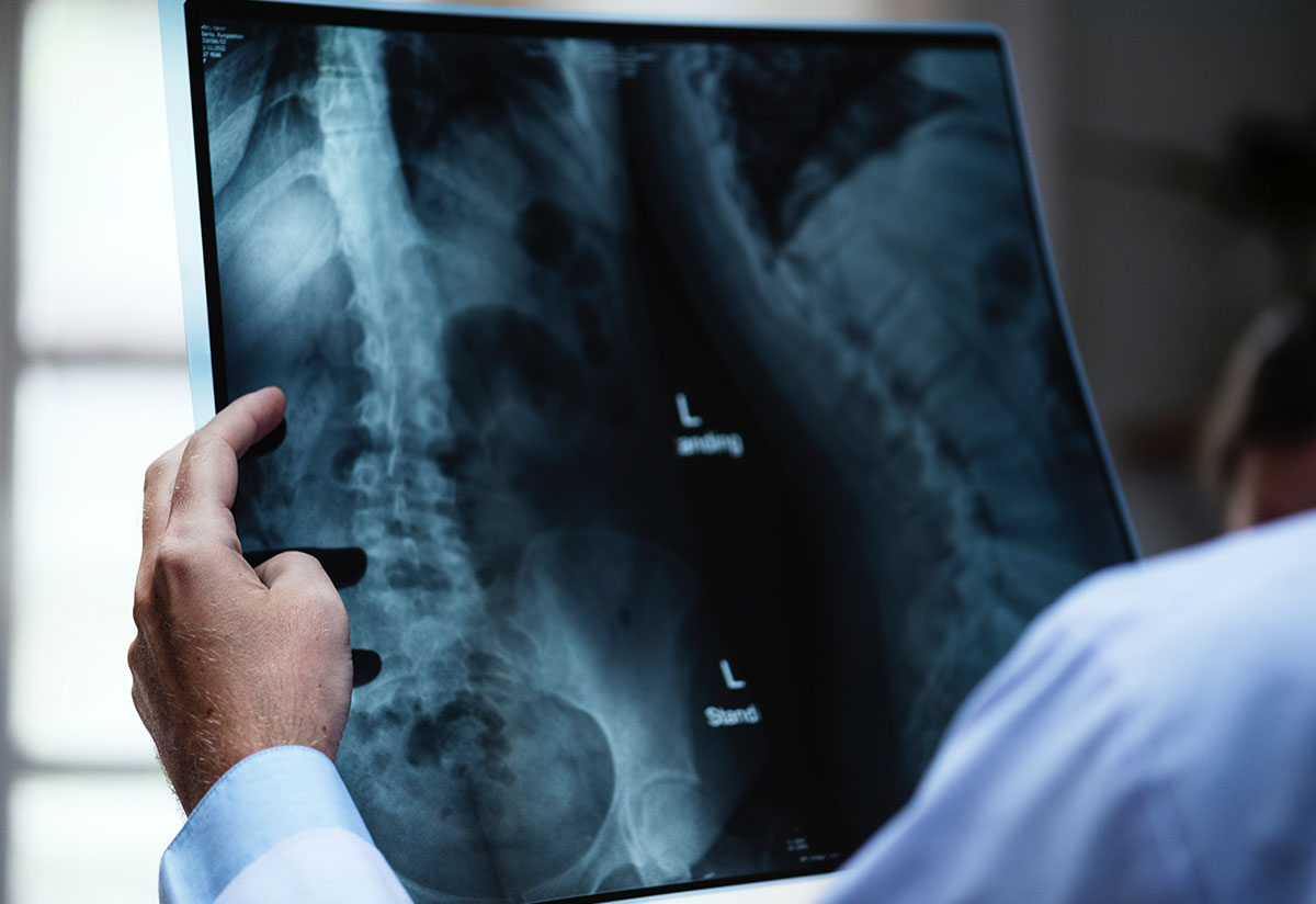 radiodiagnostico-malaga
